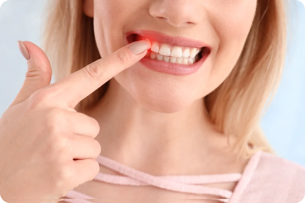 adobestock Maladie des gencives : la parodontite Dentistes et ophtalmologue à Saint-Ouen-sur-Seine