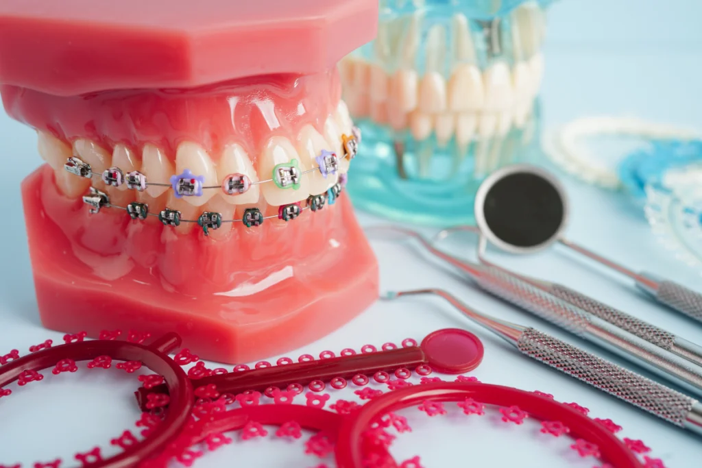 appareils dentaires metaliques paris Soins dentaires Dentistes et ophtalmologue à Saint-Ouen-sur-Seine