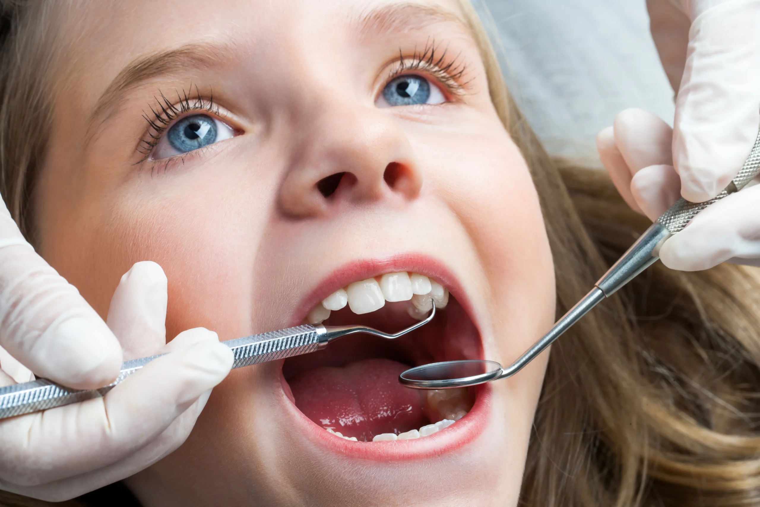 dentiste enfant scaled Soins dentaires Dentistes et ophtalmologue à Saint-Ouen-sur-Seine